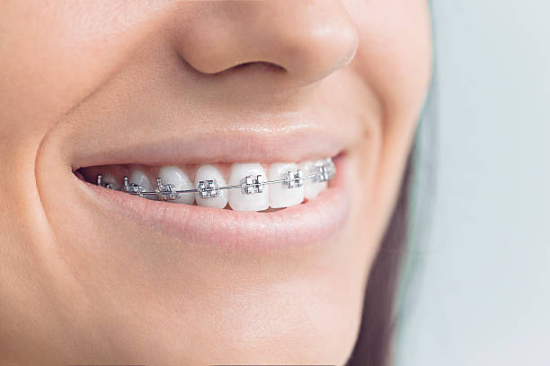 Best Wisdom Tooth Removal  in Pemberville, OH